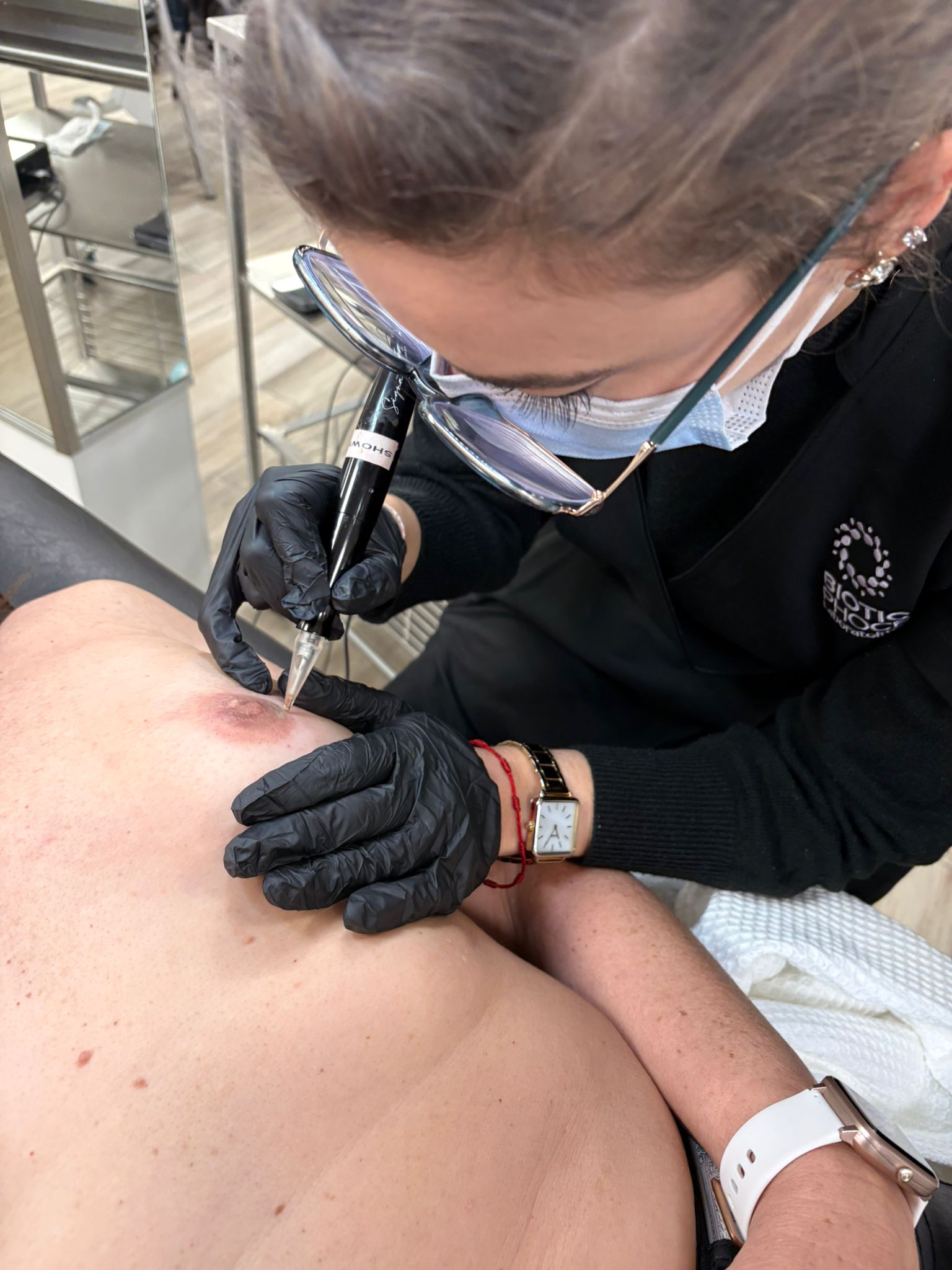 Reconstruction d'aréoles 3D par dermopigmentation après mastectomie - Sarah Ink Studio Toulouse